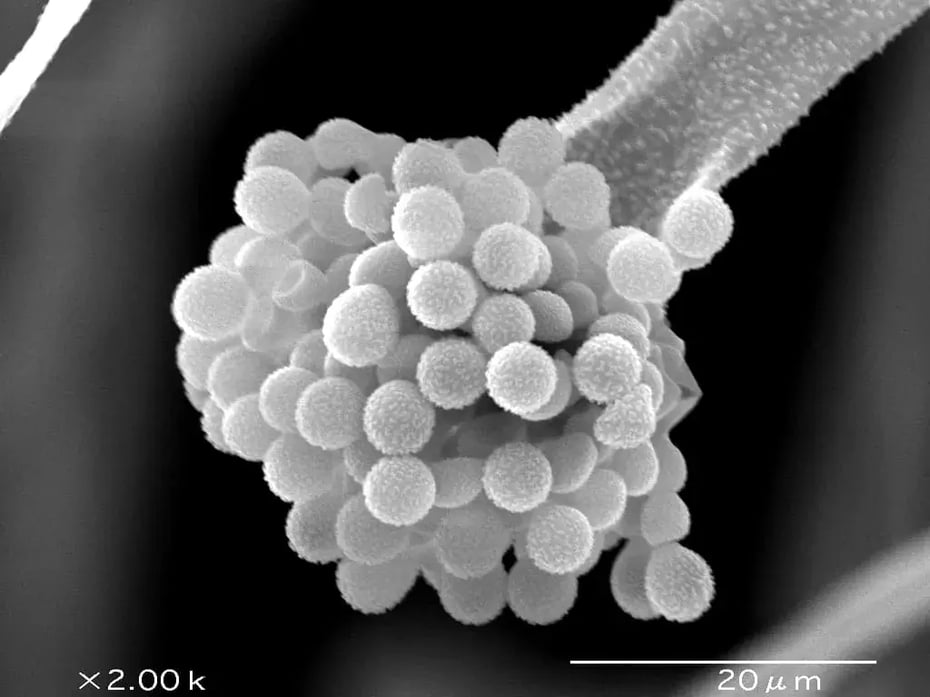 発酵食品をつくる際に大活躍する「麹菌」の顕微鏡写真（写真提供：独立行政法人酒類総合研究所）